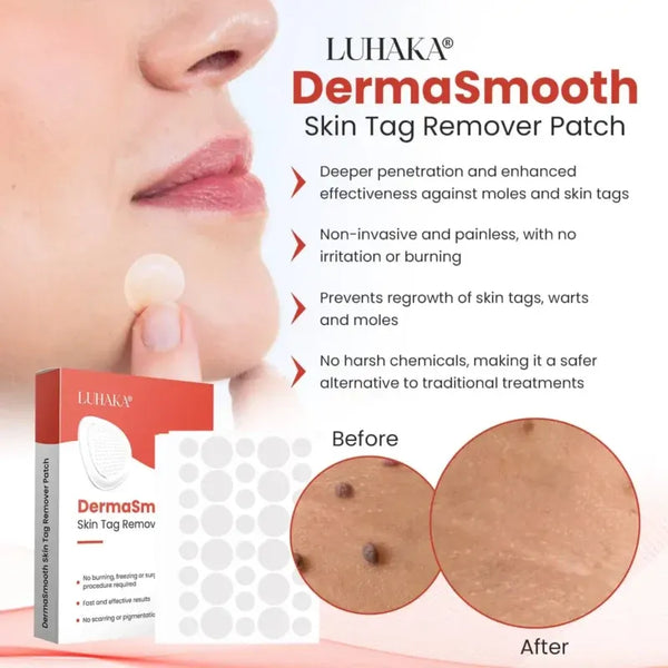 Derma Smooth Skin Tag Removal Patch - 72 Patches