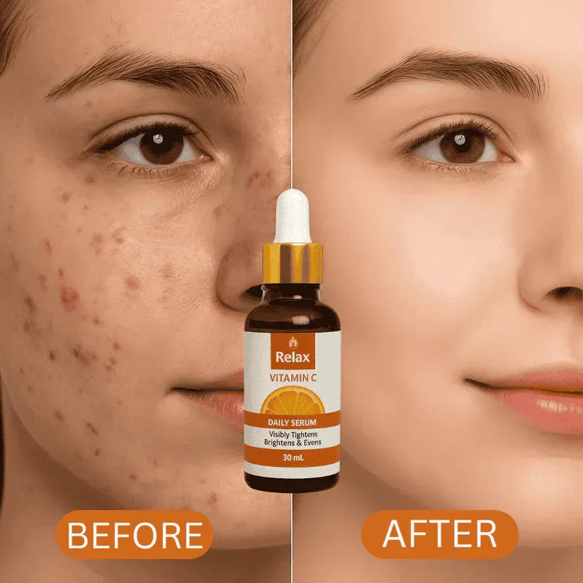Relax UK Vitamin C Face Serum 30ml | 100% Orignal