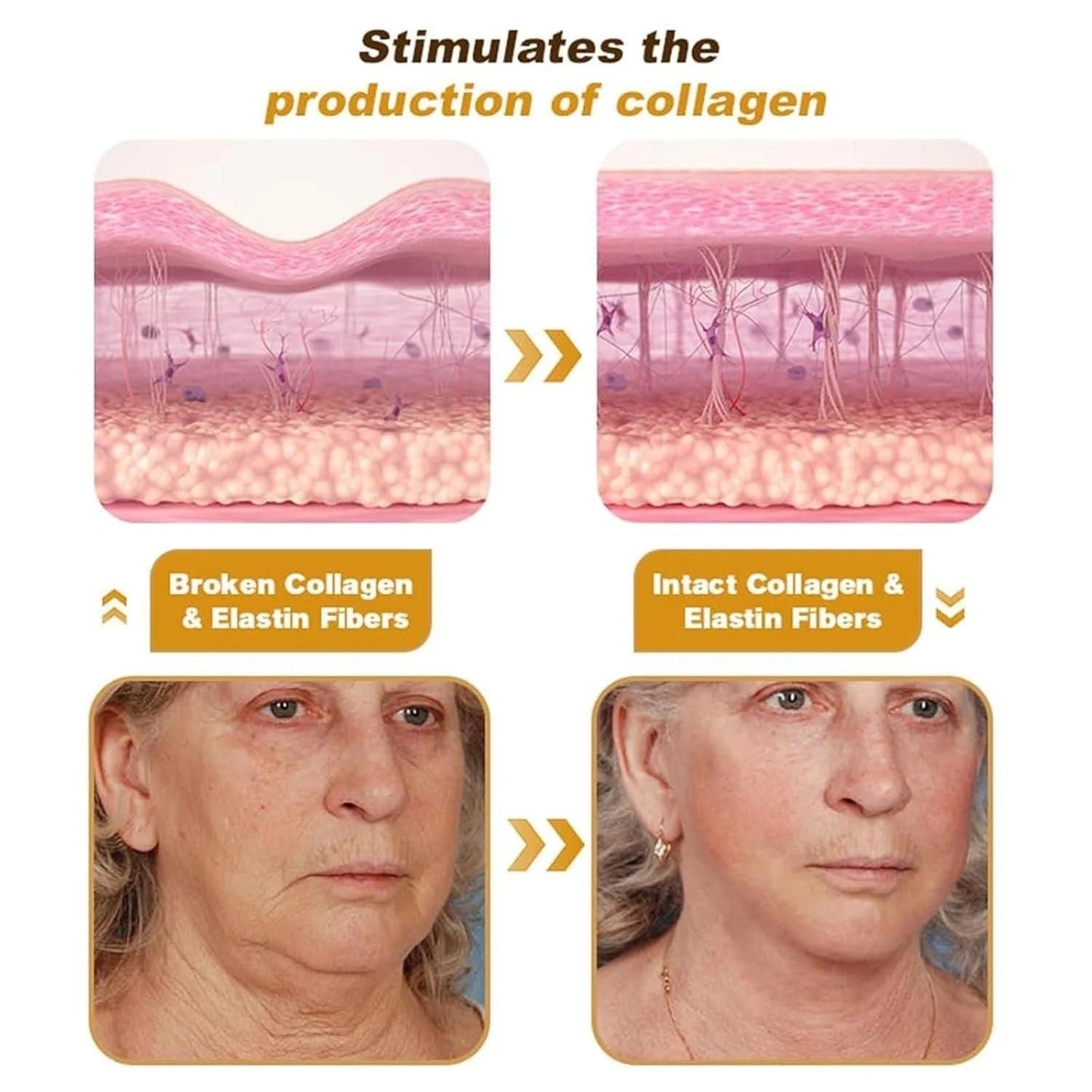 Botox Bee Venom Wrinkle Repair Cream | Buy 1 Get 1 Free